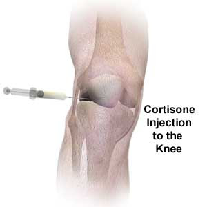 MRSA Infection after Cortisone Injection